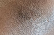 One of the main factors that can cause an overgrowth of Malassezia is hot and humid weather. (Angela Roma/ Pexels)